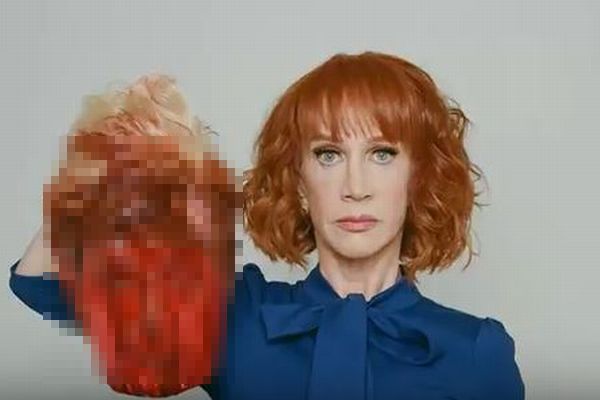 血塗られたトランプ大統領の生首画像に非難が集中、米コメディアンが謝罪