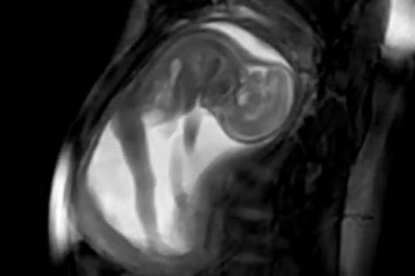 超音波とMRIを組み合わせ、胎児の動く様子を鮮明に捉えた動画がすごい