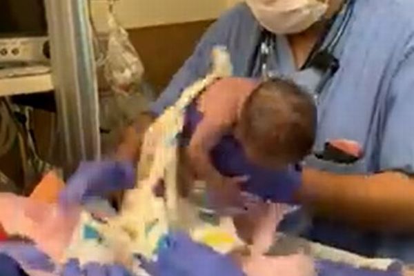 医療スタッフが赤ん坊を落とし、その後脳内出血に！問題の動画が公開される