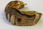 カバの牙と金で出来た200年前の入れ歯が発見される