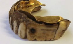 カバの牙と金で出来た200年前の入れ歯が発見される