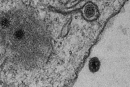 90％も特定できない遺伝子を持つ未知のウイルス、ブラジルの研究者が発見