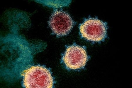新型コロナウイルス、米国でついに癌や心臓病を抜き死因トップに？