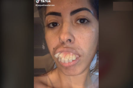 歯が変わっただけで別人に、ブラジル女性のTikTok動画に唖然