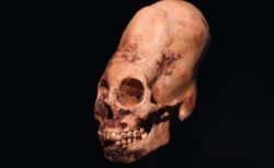長い頭蓋骨の謎が判明？ハンガリーの村がローマ帝国崩壊後の人々を受け入れていた