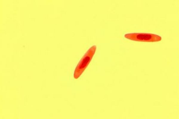 ハエに寄生し、ゾンビに変える2つの菌類をデンマークの研究者が発見