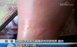 武漢ウイルス研究所での調査の実態を示す動画、コウモリに咬まれ腫れる様子も