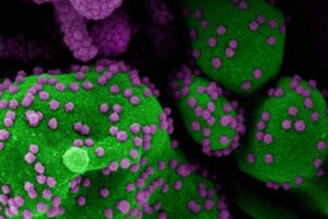 イギリスで感染者の75％からインド変異株を検出、新規感染者も少しずつ増加