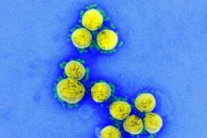 新型コロナによる重症化や死亡のリスクを高める遺伝子を特定