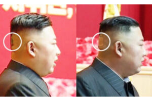 金正恩氏の後頭部に変色と絆創膏、健康状態にさらなる異変か