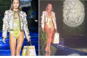 フェンディ×ヴェルサーチの初コラボコレクションにインスリンポンプをつけたモデルが登場