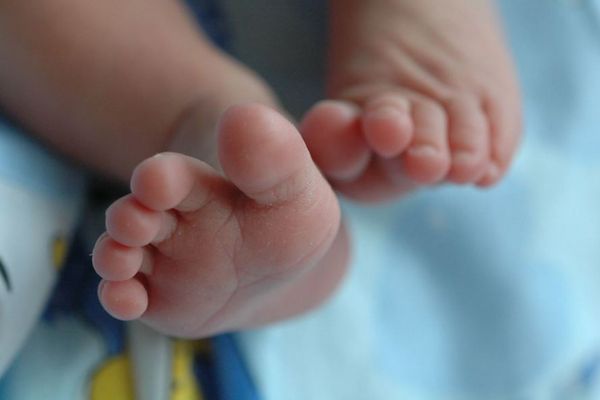 本物の人間の尻尾を生やした赤ちゃん、ブラジルで誕生