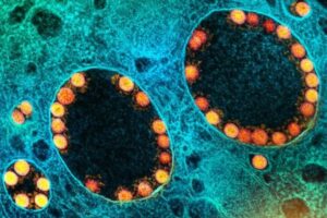 少しずつ世界に広がる「オミクロン」株、最初に発見した南アの学者の意見とは？