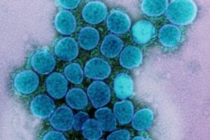 イスラエルで、新型コロナとインフルへの同時感染「フルローナ」の症例を確認