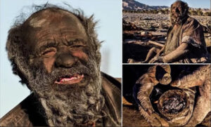67年間風呂に入らない「世界最汚」の男性、医師のチェックで健康そのものと判明