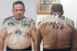 スプーン85個を皮膚に載せてギネス記録認定、一種の超能力!?