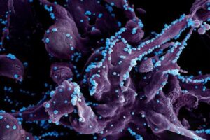 イギリスで「ラッサ熱」による3人の感染を確認、そのうち1人が死亡