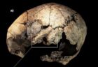 約5000年前の頭蓋骨に治療の痕跡、最古の手術が行われていた可能性