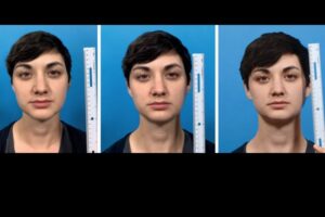 スマホのフロントカメラによる自撮りは、事実、鼻が大きく写る：大学調査