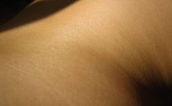 53歳の女性の皮膚細胞を、30歳ほど若返らせることに成功