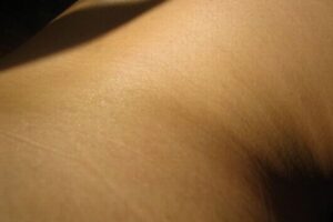 53歳の女性の皮膚細胞を、30歳ほど若返らせることに成功