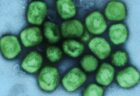 イギリスでサル痘の患者がさらに確認され、71人に