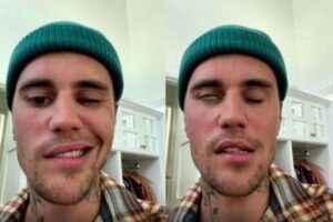 J・ビーバーがラムゼイ・ハント症候群を告白、顔面が麻痺した動画を投稿