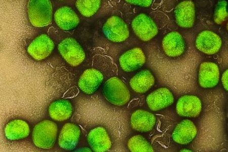 イギリスでサル痘の患者がついに300人を突破、世界26カ国で確認