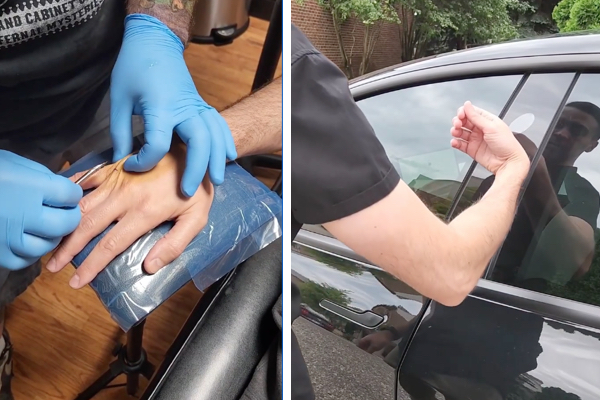 テスラ車のキーを皮膚に埋め込んだ男性、手術と使用場面を動画で投稿
