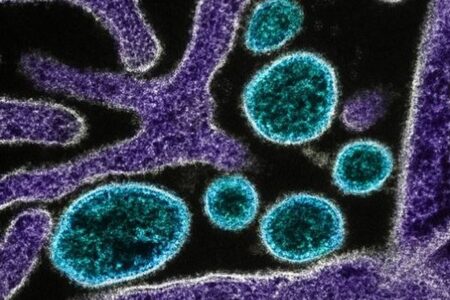 中国で動物由来の新型ヘニパウイルスを発見、35人の感染を確認