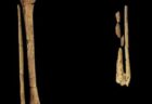 古代の人骨に切断の痕跡、約3万年前に外科手術が行われていた可能性【インドネシア】