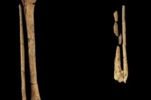 古代の人骨に切断の痕跡、約3万年前に外科手術が行われていた可能性【インドネシア】