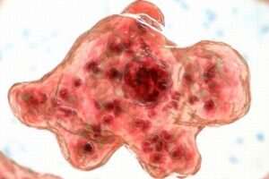 脳を冒すアメーバによって子供が死亡、きわめて稀な事例【アメリカ】