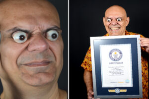 CGみたいに目が飛び出る男性、ギネス世界記録に