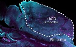 米科学者が人間の脳の一部をマウスに移植、機能させることに成功