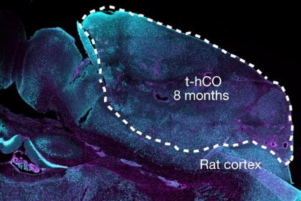 米科学者が人間の脳の一部をマウスに移植、機能させることに成功