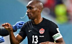 【サッカーW杯】カナダ代表のキャプテン、鼻にタンポンを挿入しプレー