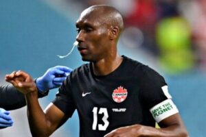 【サッカーW杯】カナダ代表のキャプテン、鼻にタンポンを挿入しプレー