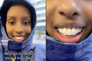 前歯を3本にしてみたら、意外と可愛い感じになると判明