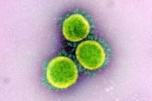 なぜ新型コロナへの感染で、嗅覚が失われるのか？米研究機関が調査