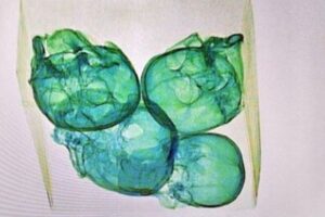 メキシコの空港で検査官が、人間の頭蓋骨4個が入った小包を発見