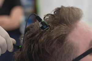 ユタ州のバイオテック企業が、すでに人間50人に脳内チップを埋め込んでいた