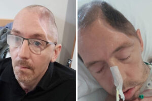 路上で喧嘩したイギリス人男性、一発殴られただけで頭部の3分の1が無くなる