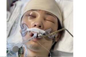 【情報求む】日本人男性か？カリフォルニア州で意識のない身元不明の男性が発見される