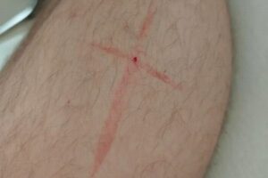 ある朝、目覚めてみたら足に十字架の血…不思議な現象に男性もびっくり