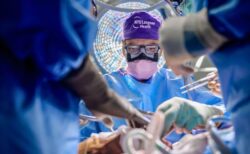 世界で初めて眼球全体の移植手術、片目を失った男性患者に実施