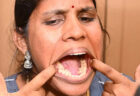 歯が38本あるインド人女性、ギネス世界記録に認定