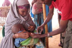 なぜ？「はしか」による世界の死者数が43%も増加：CDC報告