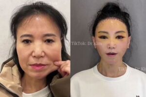 これは成功なの? Dr.キムが投稿する整形前後の画像がもはやホラー