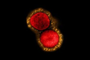 将来発生し得る未知の病原体「X」について、ダボス会議で議論